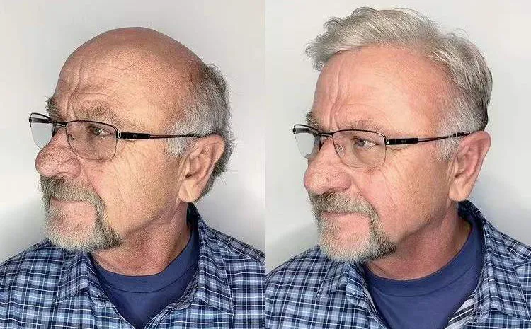 Hollywood Base Hair Toupee-Hair System with Thin Skin Perimeter and a Realistic Lace Front - Image 5