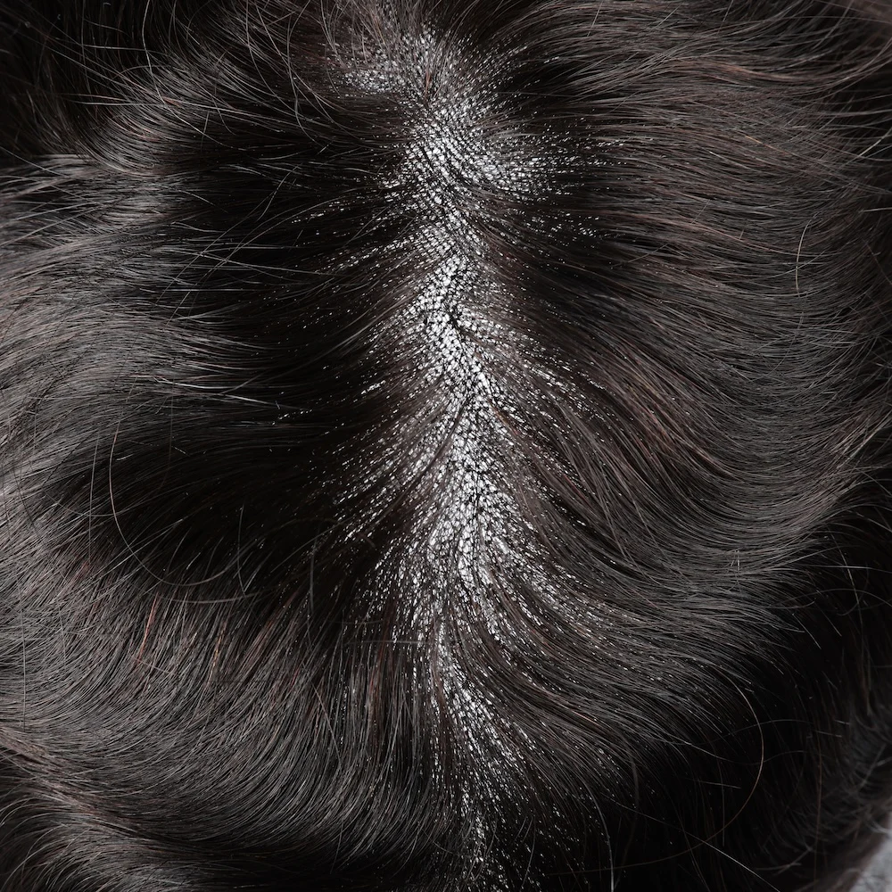 NEW AUSTRALIA-Men Hair System With a Wider PU Perimeter - Image 2