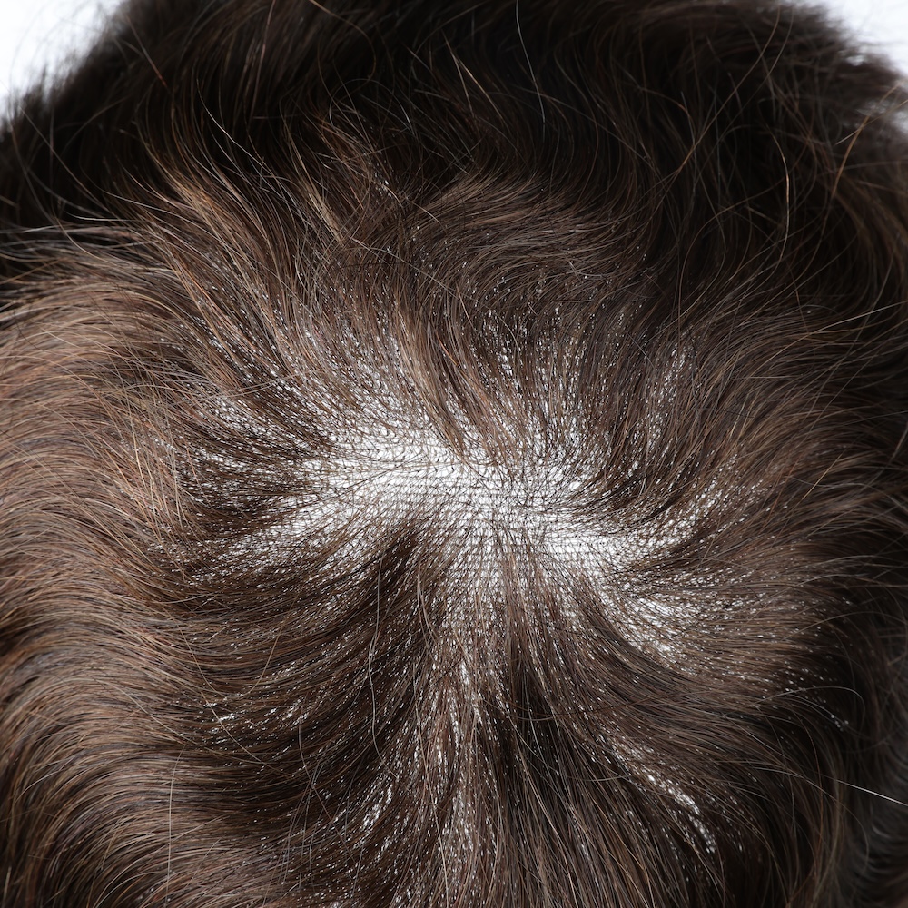 Full Swiss Lace Hair System Men Toupee Wholesale price - Image 4
